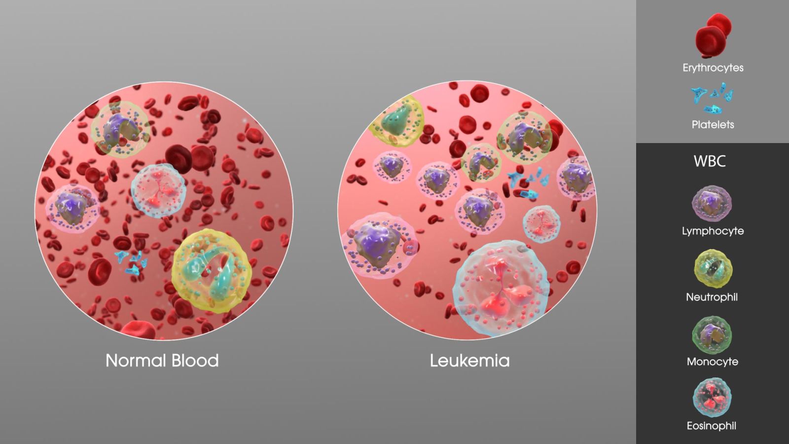 Normal Blood Cells vs Leukemia Blood Cells